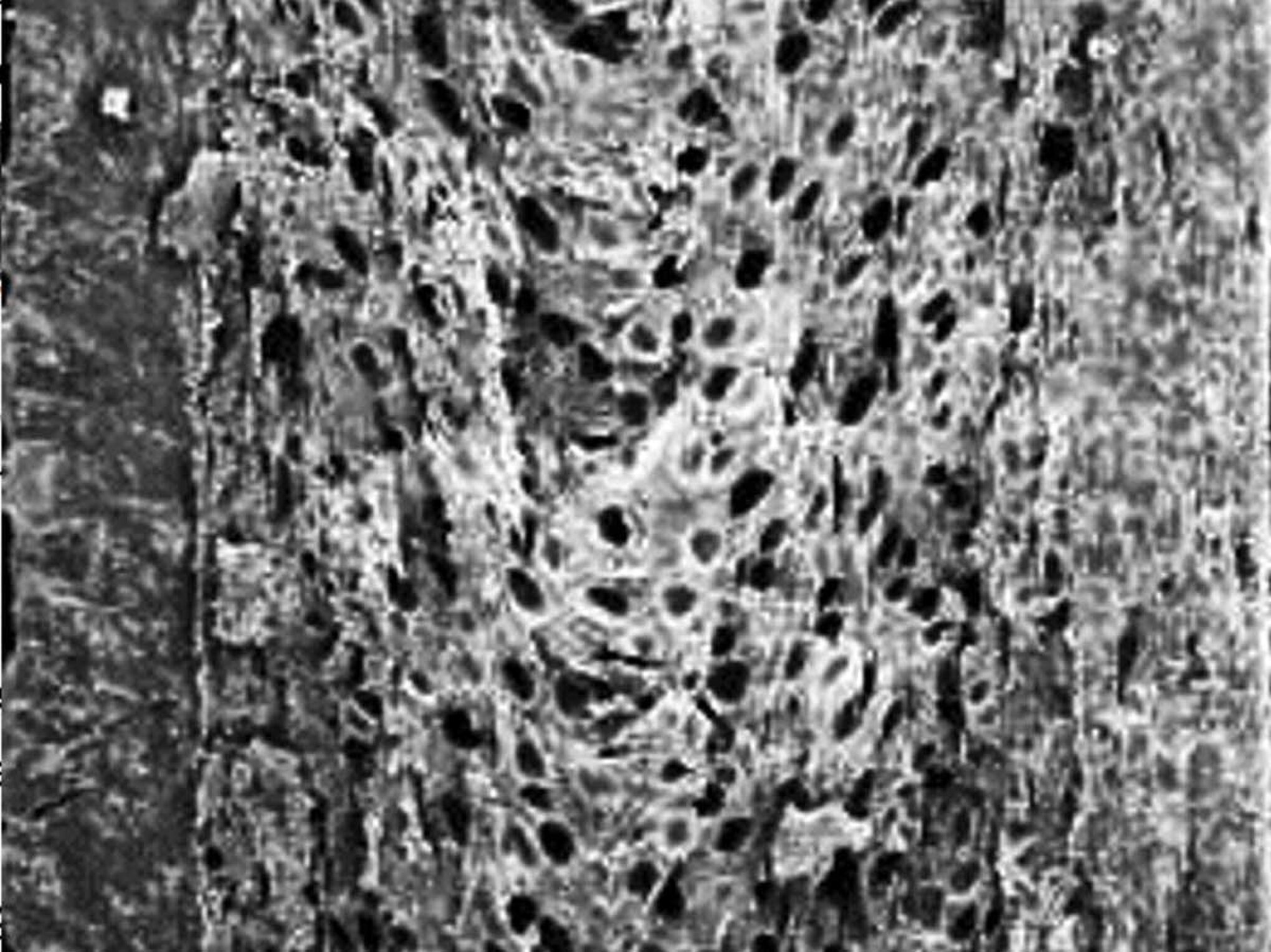 Thermoplastischer Schaumguss (MuCell)